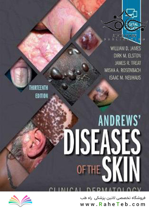 Andrews