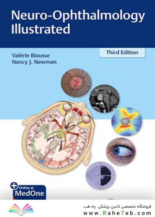 Neuro-Ophthalmology Illustrated2020 چشم پزشکی مصور