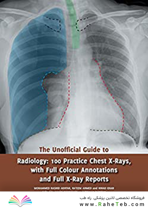 The Unofficial Guide to Radiology2017
