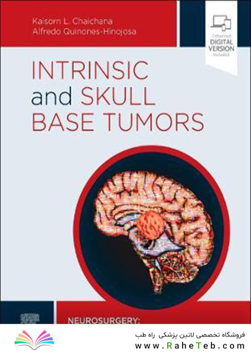 Intrinsic and Skull Base Tumors: Neurosurgery: Case Management Comparison Series2020