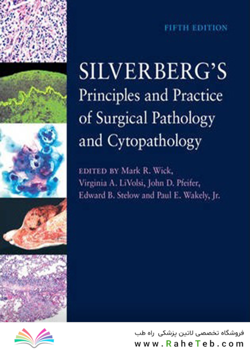 Silverberg
