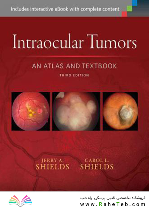 Intraocular Tumors: An Atlas and Textbook (Volume 1)2015تومورهای داخل چشم: اطلس و کتاب درسی (جلد 1)
