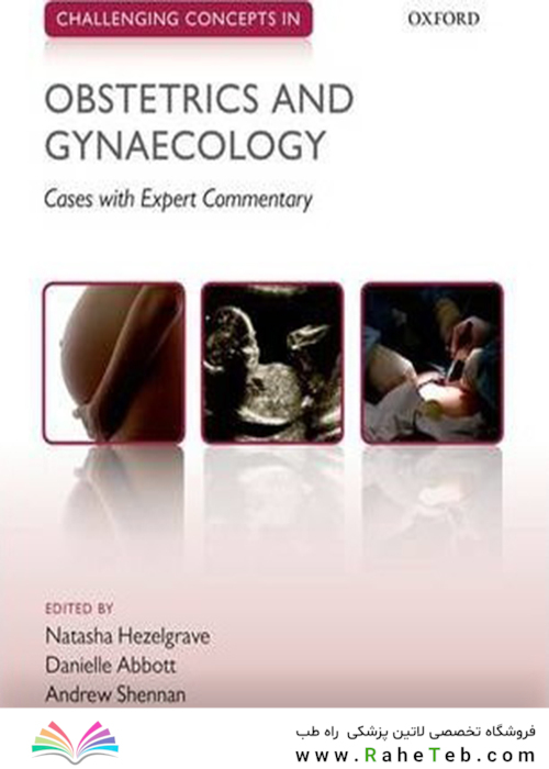 Challenging Concepts in Obstetrics and Gynaecology: Cases with Expert Commentary2015