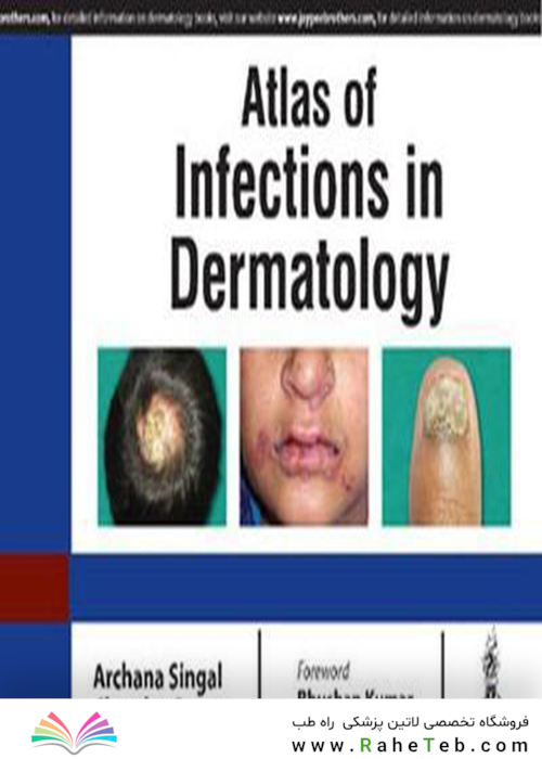 Atlas Of Infections In Dermatology2019اطلس عفونت در پوست