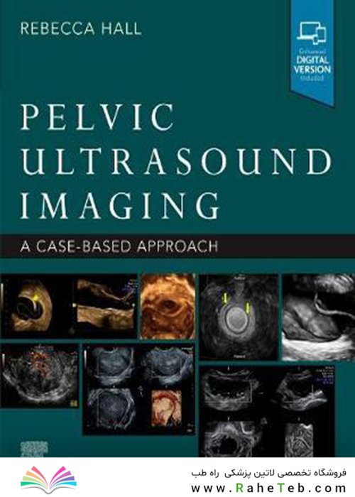 Pelvic Ultrasound Imaging: A Cased-Based Approachتصویربرداری سونوگرافی لگن