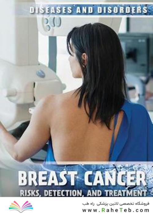 Breast Cancer: Risks, Detection, and Treatment (Diseases - Disorders)2018 سرطان پستان