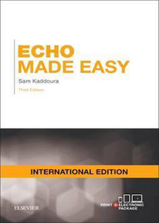 عکس Echo Made Easy International Edition 2016