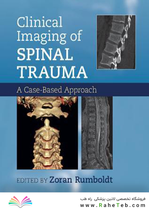 Clinical Imaging of Spinal Trauma 1st Edition2018تصویربرداری بالینی ترومای نخاعی ویرایش اول