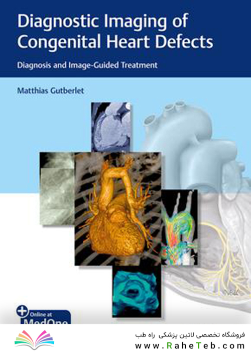Diagnostic Imaging of Congenital Heart Defects: Diagnosis and Image-Guided Treatment