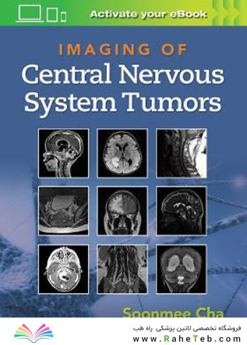 Imaging of Central Nervous System Tumors2021تصویربرداری از تومورهای سیستم عصبی مرکزی