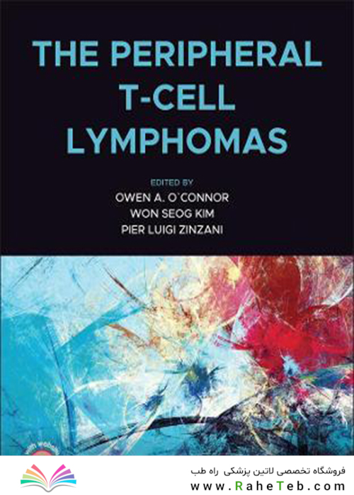 The Peripheral T-Cell Lymphomasلنفوم های سلول T محیطی