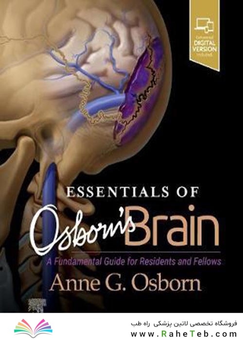 Essentials of Osborn