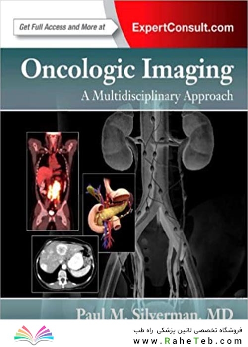 Oncologic Imaging: A Multidisciplinary Approach: Expert Consult - Online and Print