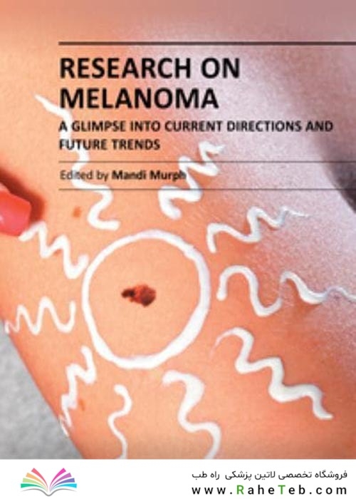 Research on Melanoma : A Glimpse into Current Directions and Future Trends2011