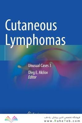 Cutaneous Lymphomas : Unusual Cases 3لنفوم های جلدی: موارد غیر معمول 3