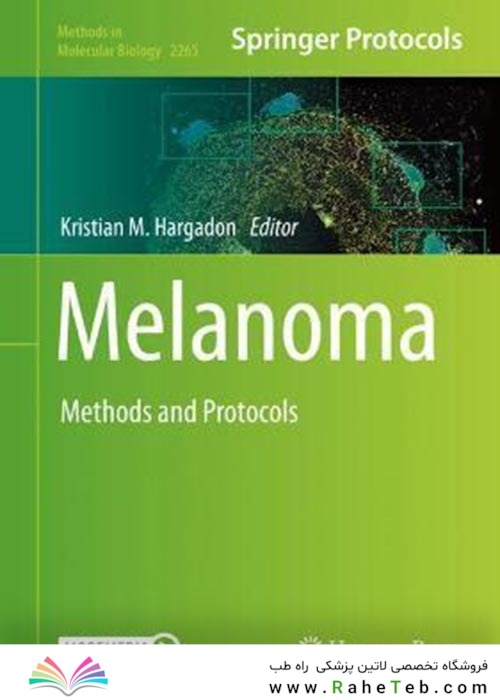 Melanoma : Methods and Protocols2021ملانوم: روشها و پروتکلها