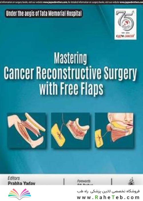 Mastering Cancer Reconstructive Surgery with Free Flaps2019
