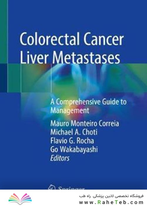 Colorectal Cancer Liver Metastases : A Comprehensive Guide to Management2020