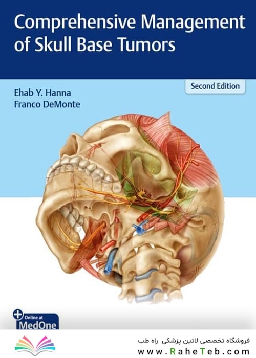 Comprehensive Management of Skull Base Tumors, Second Edition2021