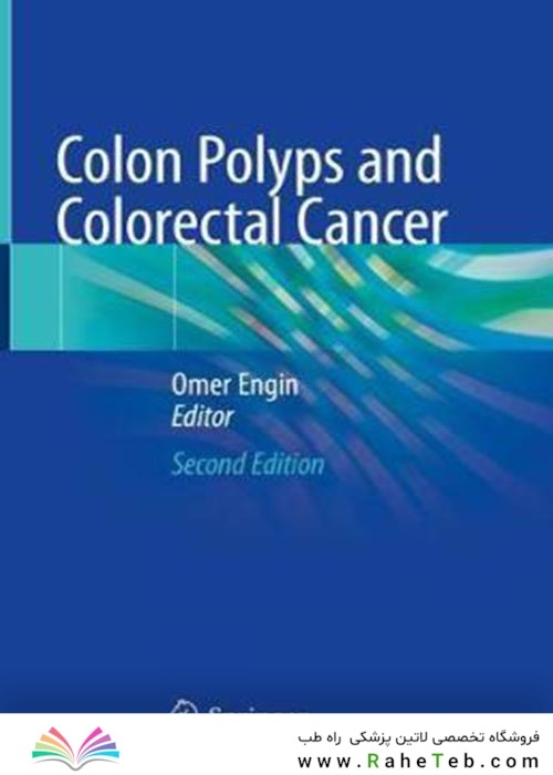 Colon Polyps and Colorectal Cancer  پولیپ های روده بزرگ و سرطان روده بزرگ