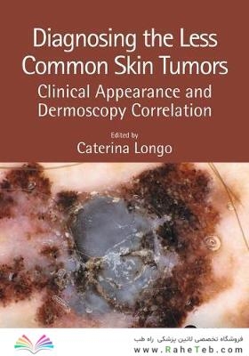 Diagnosing the Less Common Skin Tumors : Clinical Appearance and Dermoscopy Correlation2019