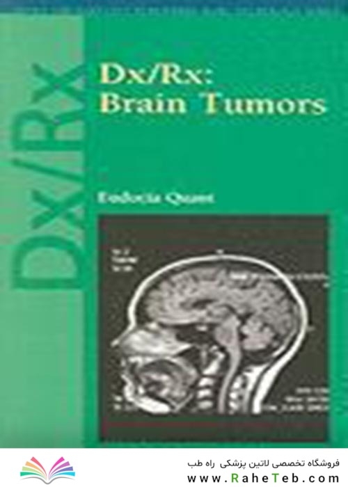 Dx/Rx : Brain Tumors