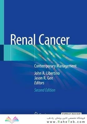 Renal Cancer : Contemporary Managementسرطان کلیه