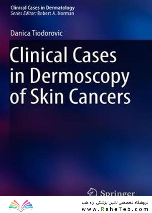 Clinical Cases in Dermoscopy of Skin Cancersموارد بالینی درموسکوپی سرطانهای پوست