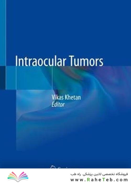 Intraocular Tumorsتومورهای داخل چشمی