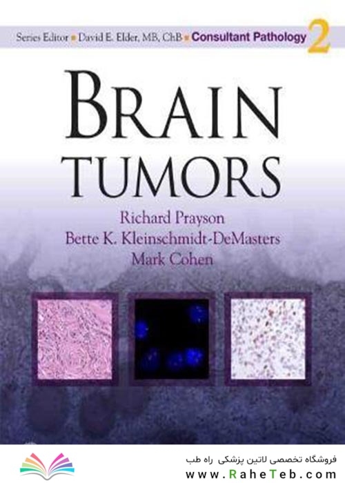 Brain Tumors2010