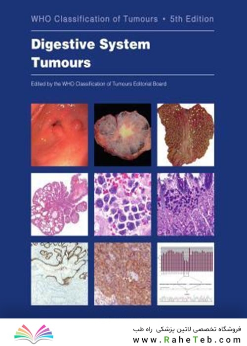WHO Classification of Tumours. Digestive System Tumours : WHO Classification of Tumours