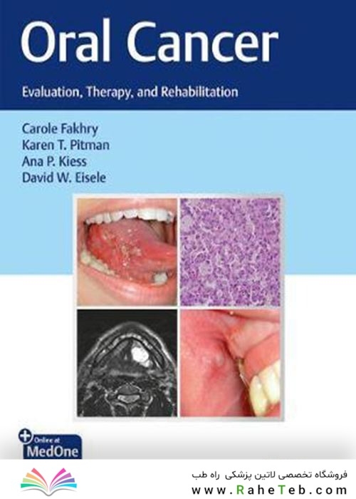 Oral Cancer : Evaluation, Therapy, and Rehabilitationسرطان دهان: ارزیابی ، درمان و توانبخشی