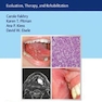 Oral Cancer : Evaluation, Therapy, and Rehabilitationسرطان دهان: ارزیابی ، درمان و توانبخشی