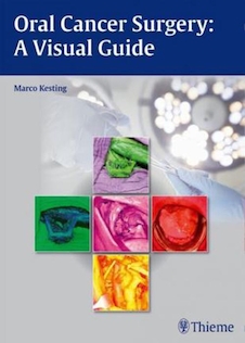 عکس Oral Cancer Surgery : A Visual Guideجراحی سرطان دهان