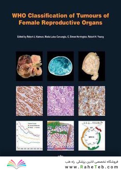 WHO Classification of Tumours of Female Reproductive Organs : WHO Classification of Tumours, Volume 6