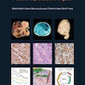 WHO Classification of Tumours of Female Reproductive Organs : WHO Classification of Tumours, Volume 6