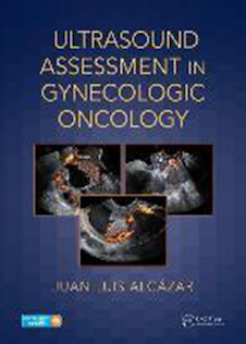 عکس ارزیابی سونوگرافی در سرطان زنان