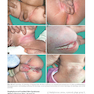 Color Atlas & Synopsis of Pediatric Dermatology 2021