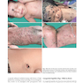 Color Atlas & Synopsis of Pediatric Dermatology 2021