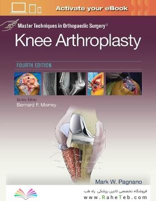Master Techniques in Orthopedic Surgery: Knee Arthroplasty2019