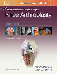 عکس Master Techniques in Orthopedic Surgery: Knee Arthroplasty2019