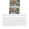 Master Techniques in Orthopedic Surgery: Knee Arthroplasty2019