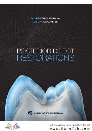 Posterior Direct Restorations 1st Edition