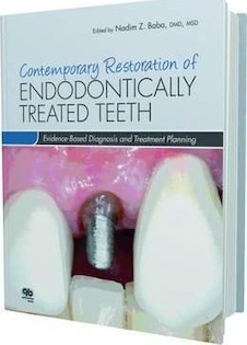 عکس Contemporary Restoration of Endodontically Treated Teeth