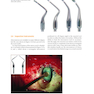 Microsurgery in Endodontics