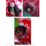 Microsurgery in Endodontics