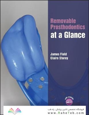 Removable Prosthodontics at a Glance