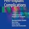 Peri-Implant Complications : A Clinical Guide to Diagnosis and Treatment