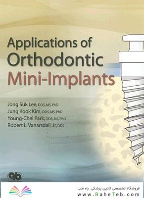 Applications of Orthodontic Mini Implants