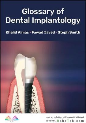 Glossary of Dental Implantology